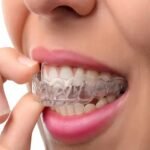 3 Benefits of Fixed Braces for Patients